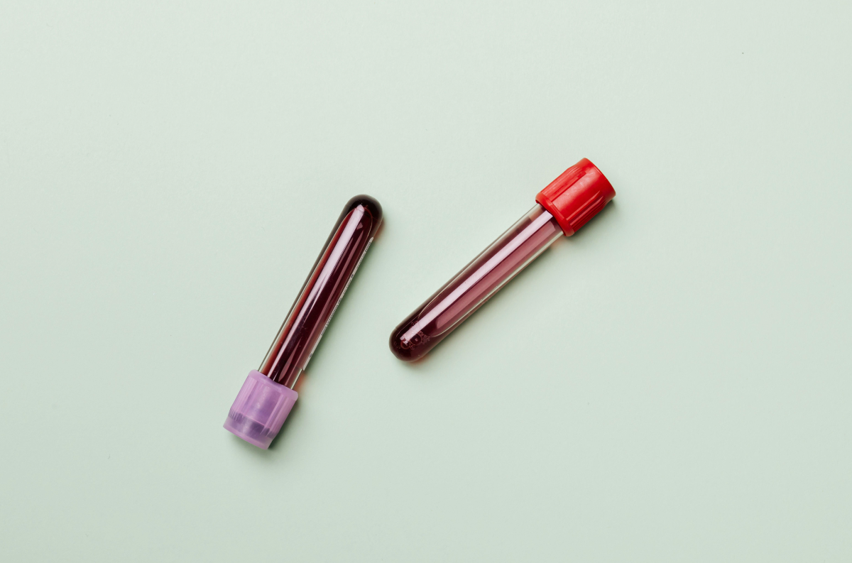 What your blood test might really be saying about your iron