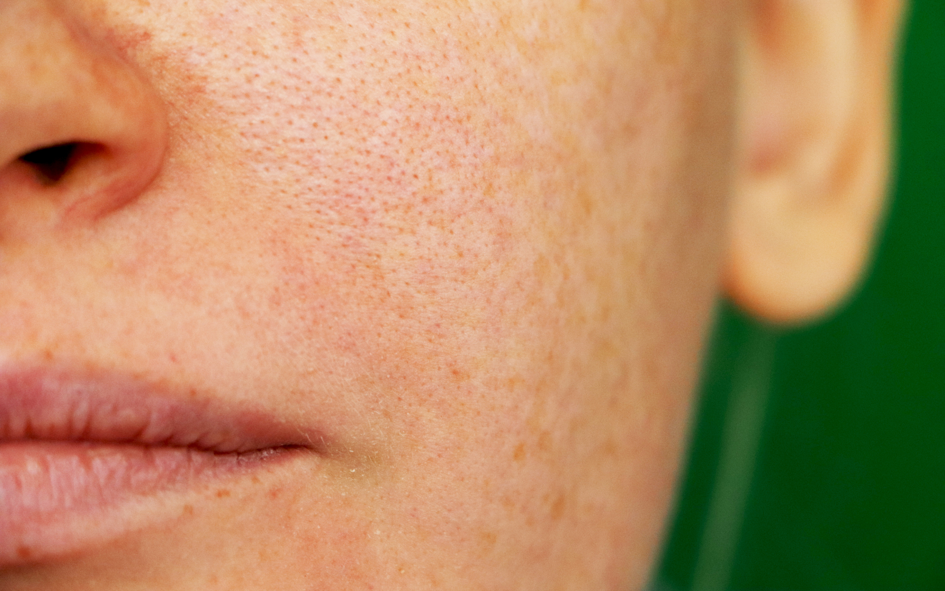 Is pigmentation one of your skin challenges?