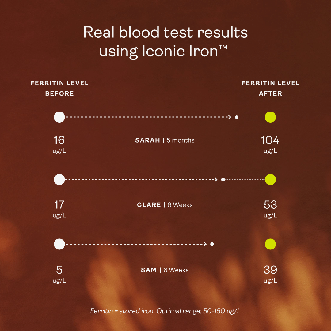 Iconic Iron™